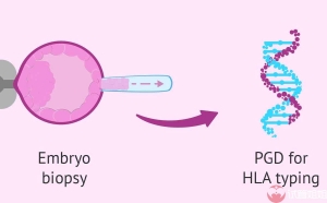 男性精子活力差想做深圳三代试管婴儿需要先治疗多久呢？