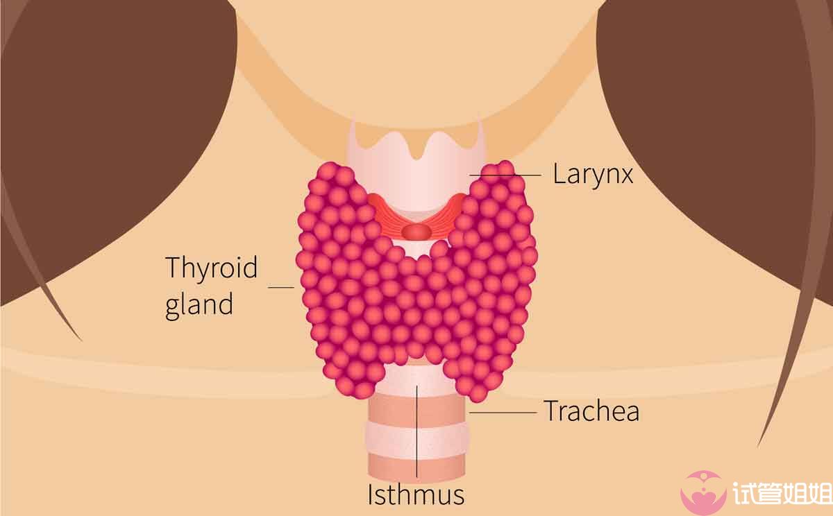 女性甲状腺功能亢进