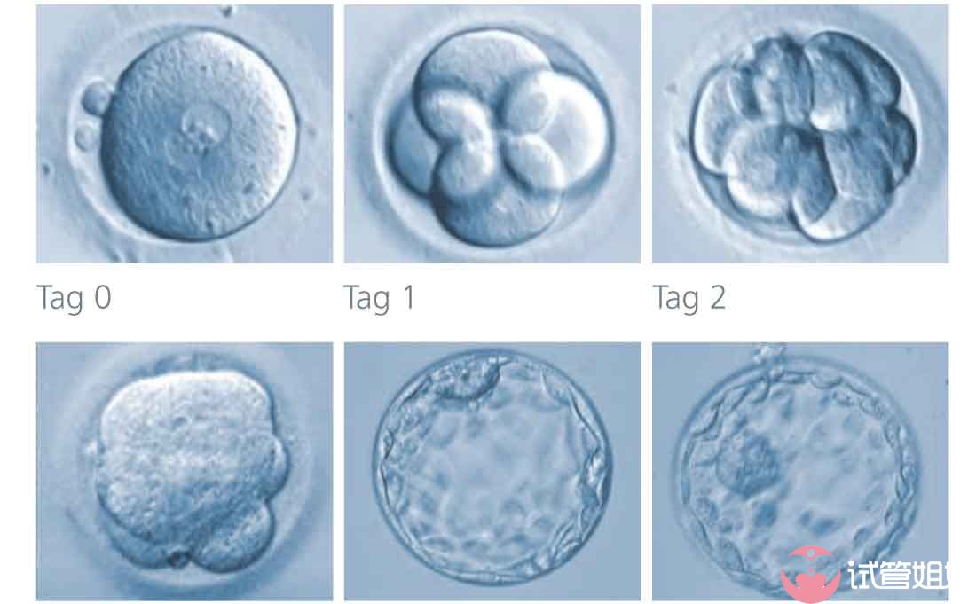 分裂最快的胚胎被认为是最健康和最有可能植入的胚胎