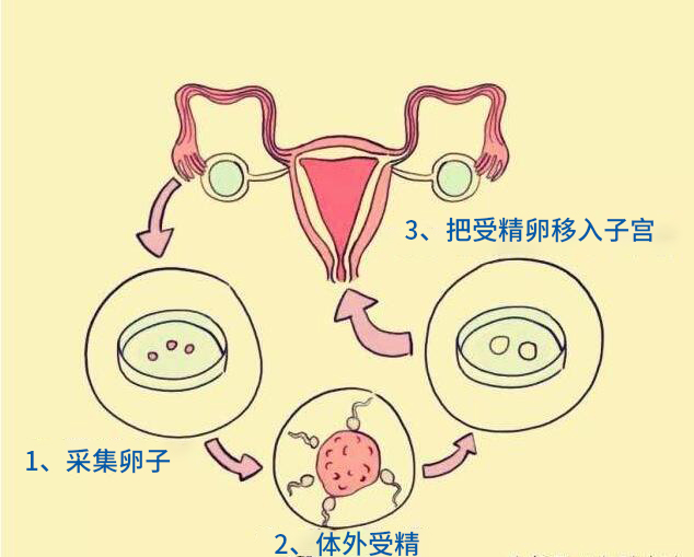 千禧试管费用