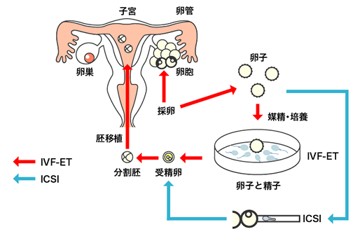 第三代泰国试管成熟吗  什么时候做比较好