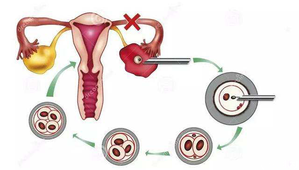 卵巢刺激方案会影响卵子质量